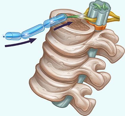 Tapete e Almofada de Acupressão e Massagem Vital - Grande 25