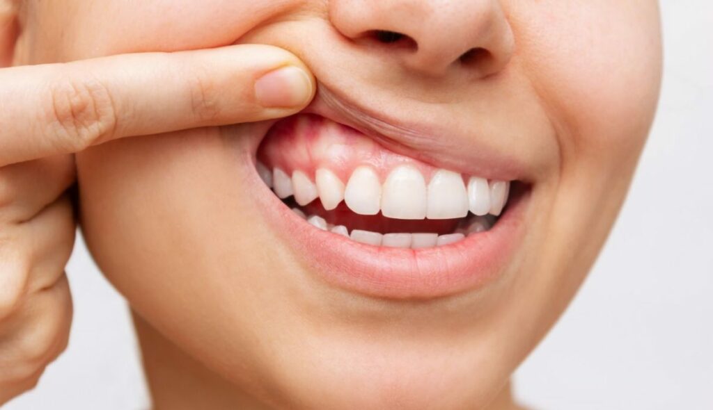 oil-pulling-yogateria6
